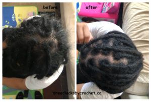 Dreadlocks Maintenance